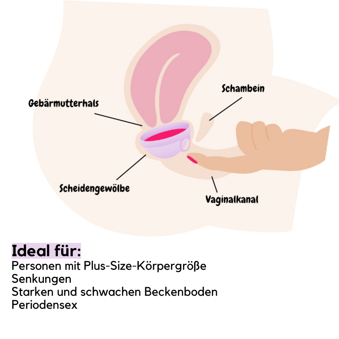 femdisc Menstruationsscheibe mit Lasche – Ansicht 6